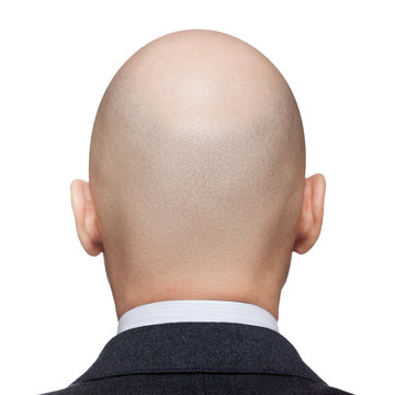 Back Of Bald Head Images – Browse 5,136 Stock Photos, Vectors, and ...